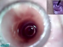 Lesbianas Extreme Cervix Play and Peehole Fucking Pene consolador